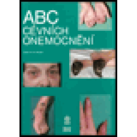 ABC cévních onemocnění - Wolfe John H. N. a kolektiv