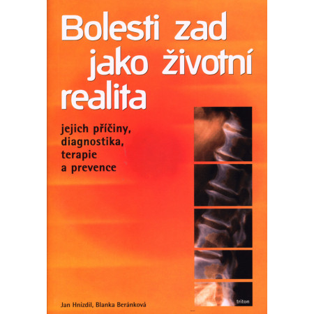 Bolesti zad jako životní realita/jejich příčiny,diagnostika,terapie a prevence  Jan Hnízdil, Blanka Beránková